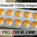 Sildenafil 100Mg Images levitra1